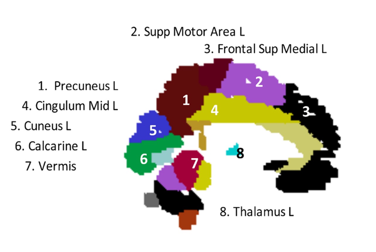 Brain MRI and CP Association